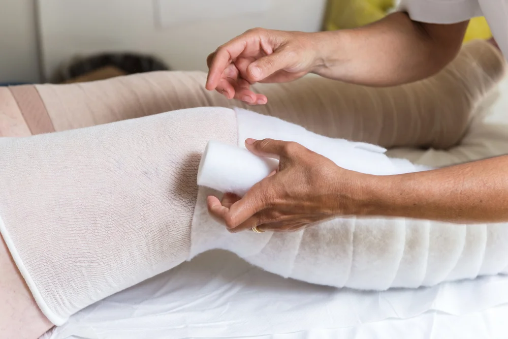 Kompressionsverband bei Lymphdrainage und Ödemtherapie