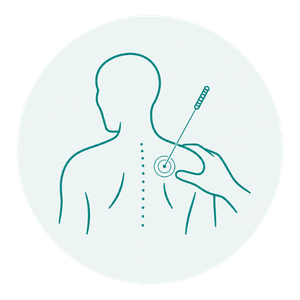 Icon für Dry Needling und Triggerpunktbehandlung
